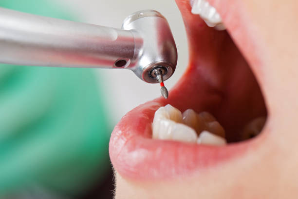 Best Emergency Treatment for Toothache in South Roxana, IL